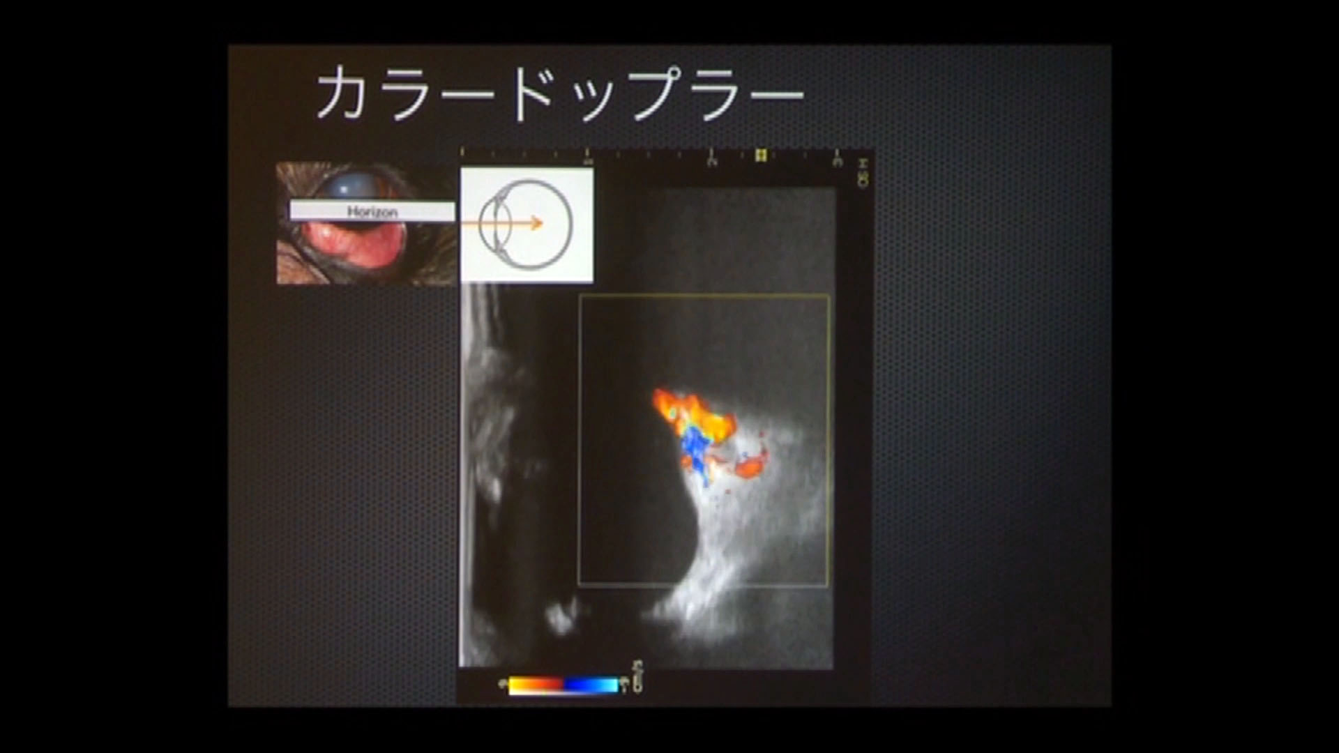 なぜ眼と眼窩の超音波検査が必要なのでしょうか?