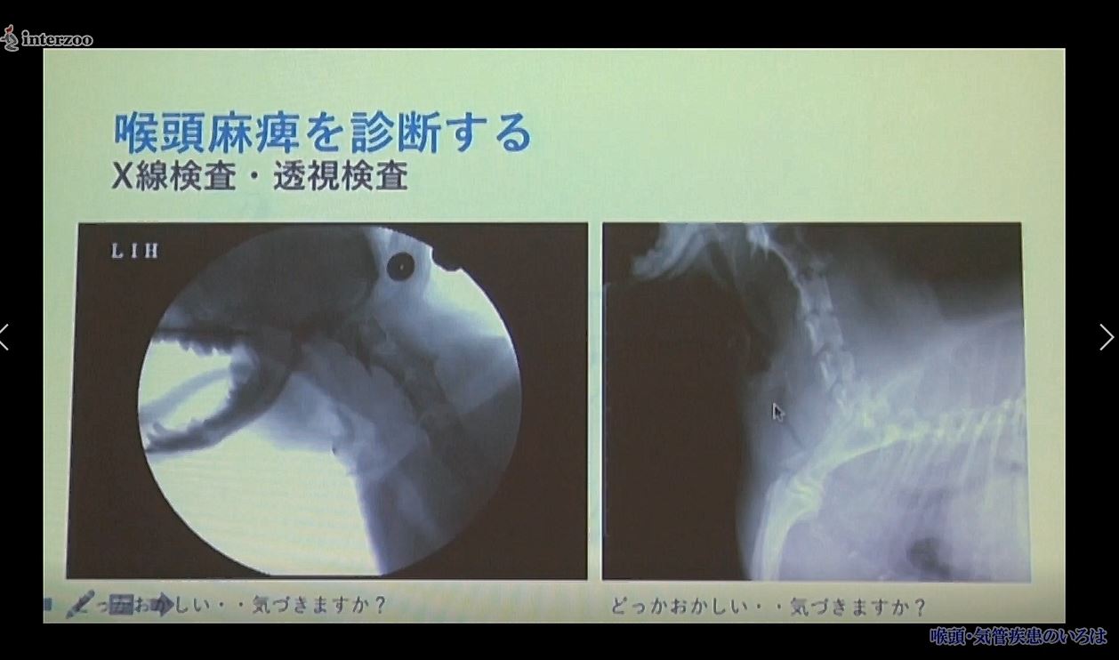 喉頭・気管疾患のいろは ～呼吸器のいろは⑤～｜ETV Store